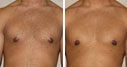 Before & After Photos